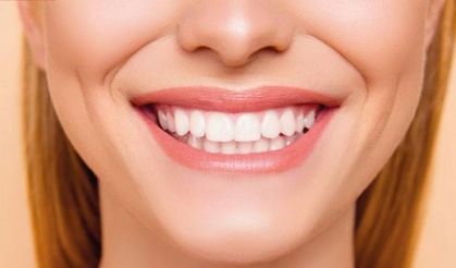 Dişlerdeki sarı lekeler nasıl geçer ? Doğal yöntemler